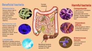 Transplantasi tinja bantu atasi penyakit kronis pria inggris