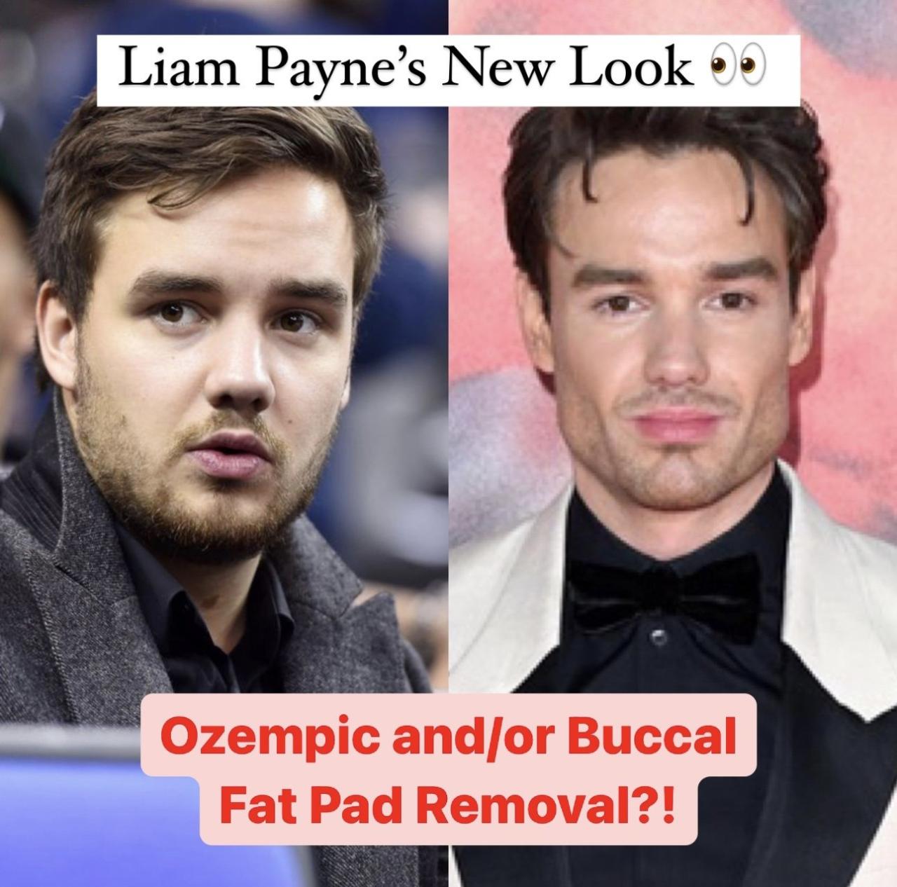 MEDIA INFORMASI INDONESIA transformasi karir Liam Payne